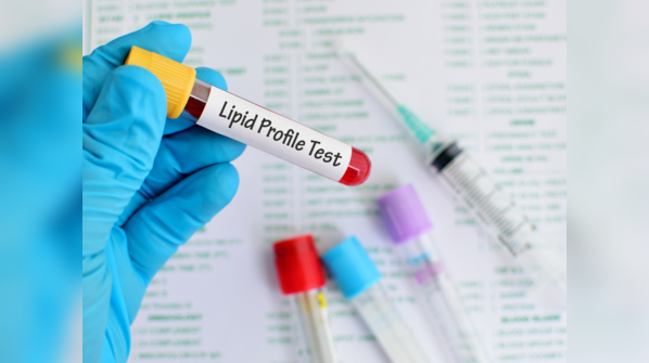Monitoring lipid markers for heart health