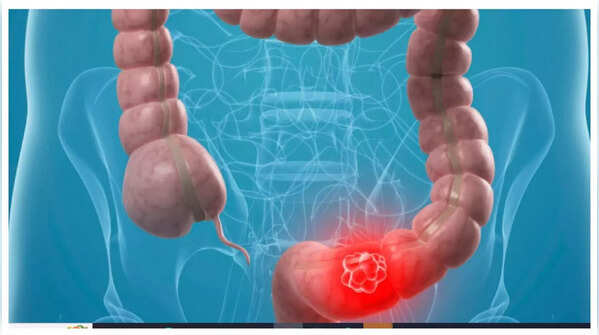 Persistent abdominal pain